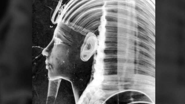 Золотая маска Тутанхамона под рентгеновскими лучами: Открытие, перевернувшее представления