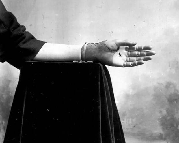 Гений протезов: работы Джеймса Джиллингема XIX века