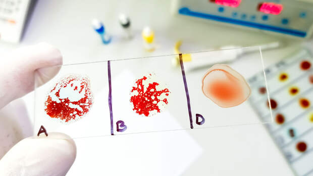 Названа группа крови, которая даёт больше всего преимуществ для здоровья