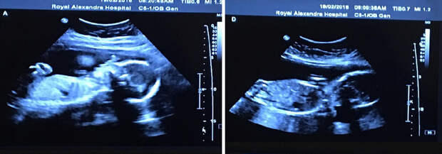 identical-quadruplet-newborn-photography-baby-photoshoot-noelle-mirabella-15