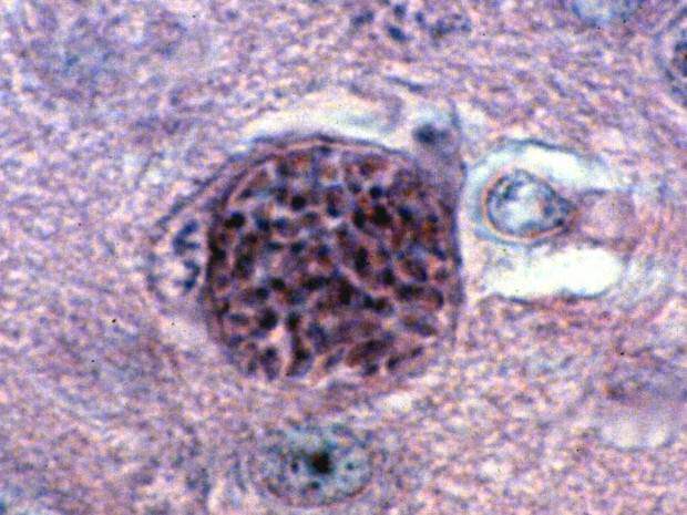 Паразит токсоплазма гонди (лат. Toxoplasma gondii)