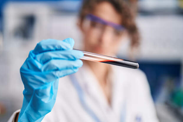 NatMed: семь маркеров крови определяют риск нескольких заболеваний у пожилых