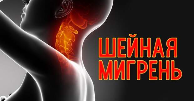 шейная мигрень таблетки