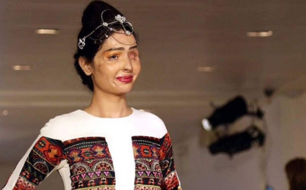 Индийская модель, облитая кислотой, произвела фурор на Неделе моды в Нью-Йорке