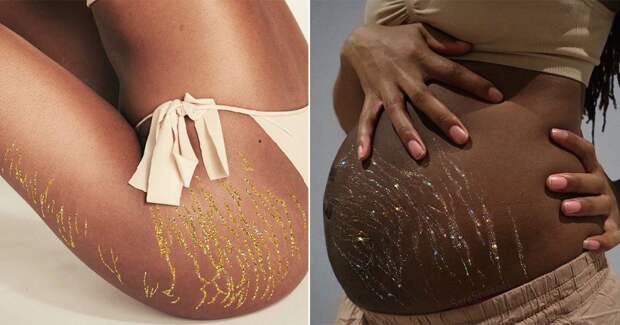 7 удивительных фото, как художница превращает растяжки на теле в украшение