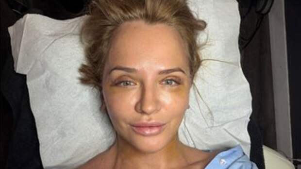 Жена владельца российских похоронных бюро показала лицо после пластики в Париже