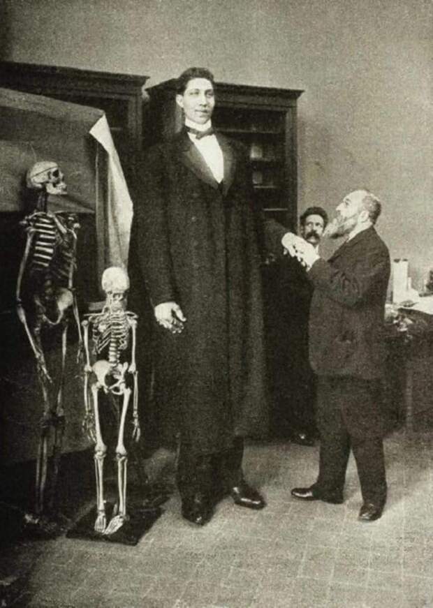 2. Самый высокий россиянин 100 лет назад, россия, фото