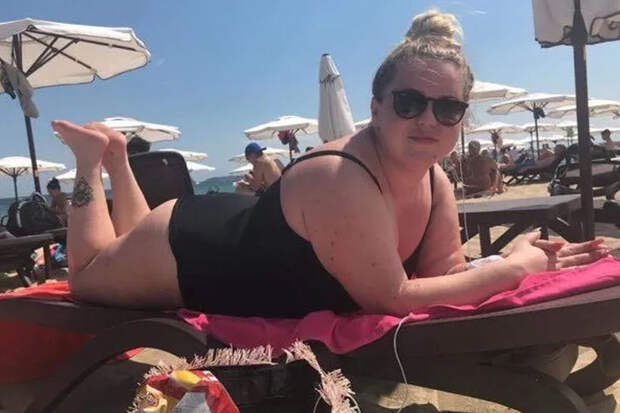 Ирландка столкнулась с меланомой в 24 года после регулярного посещения солярия