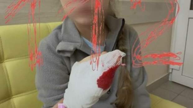 Пострадавшая девочка / Фото: Telegram-канал 