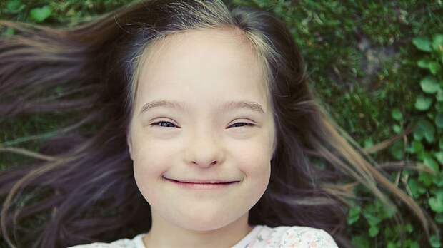 Почему люди с синдромом Дауна похожи друг на друга: объяснение генетики