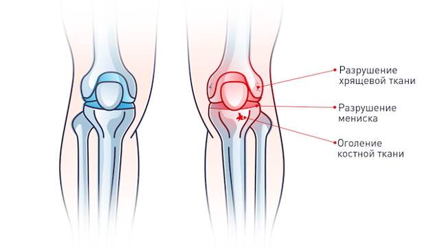 Лечение суставов и позвоночника в Тюмени: цены