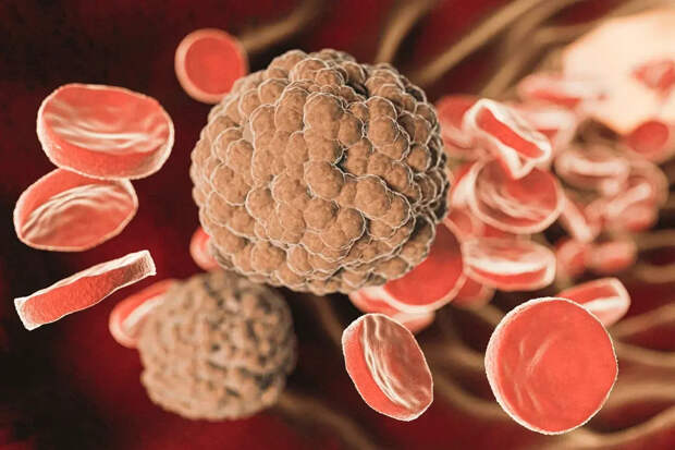 Малышева раскритиковала пациентку с раком, отказавшуюся от лечения по совету психолога