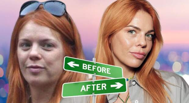 Её лицо рухнуло: жуткая пластика и уколы красоты, превратившие Анастасию Стоцкую в «Овсиенко»