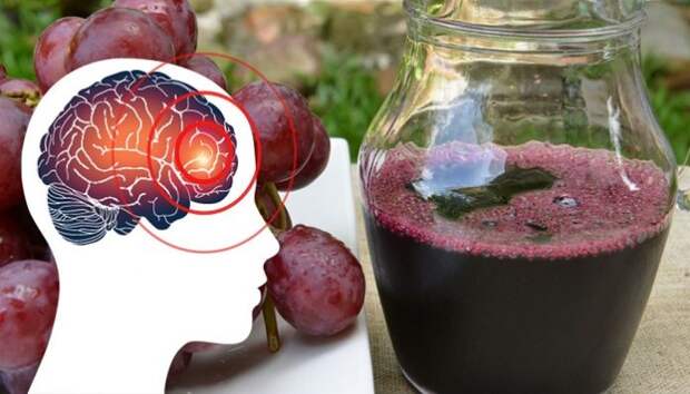 JV_July_07_06_Why-Anyone-With-a-Migraine-Should-Drink-Grape-Juice_-These-Are-The-Results