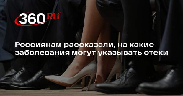 Врач Кондрахин: отеки могут появиться из-за гипотериоза и недосыпа