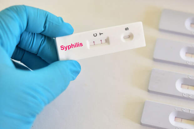 Врач Заславский: лечение сифилиса занимает от 10 до 42 дней с учетом стадии