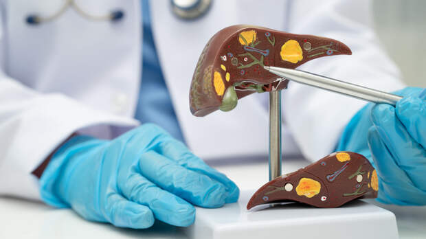 Почему печень увеличивается и как это лечить: отвечает врач-гепатолог