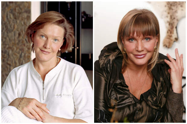 Елена Проклова пластика лица фото до и после