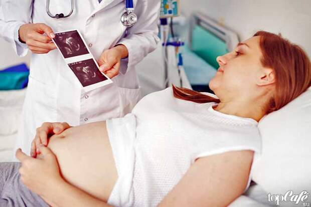 10 фактов, связанных с беременностью: Двойная беременность