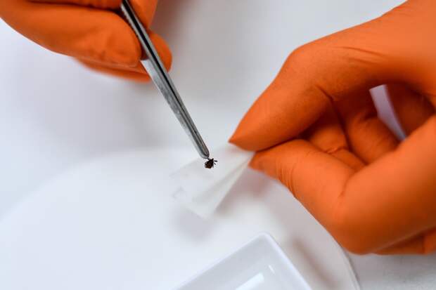 Клещ размером с пятикопеечную монету неделю провел в заднем проходе россиянина