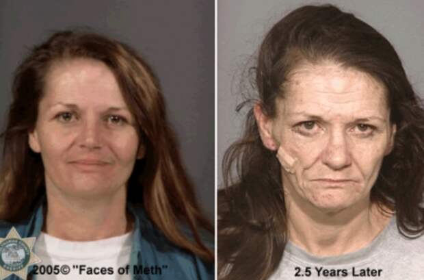 За 2,5 года наркотиков эта женщина 30 с небольшим выглядит на 60 лет - портал "ЗдравКом"
