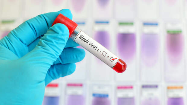 Первые симптомы вируса Нипах и меры защиты перечислили в Роспотребнадзоре