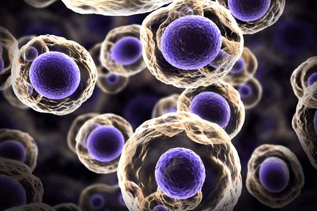 Стволовые клетки как потенциальное лечение рассеянного склероза: клиническое исследование