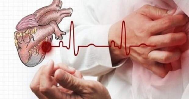 Как спасти человека при сердечном приступе за 10 секунд