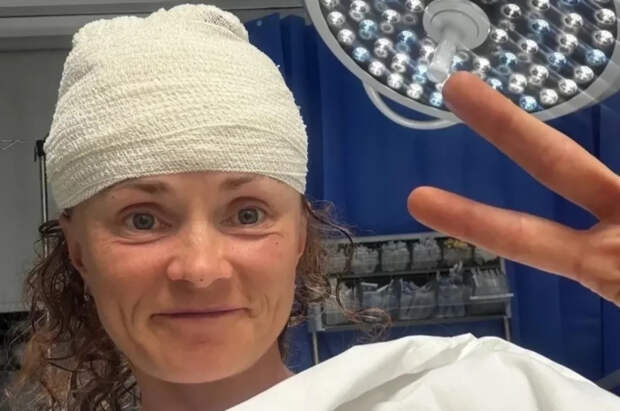 Вся в крови, скальпа нет: на российскую спортсменку на Кипре напали собаки