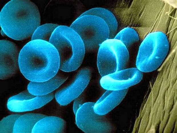 голубой-оттенок-кожи