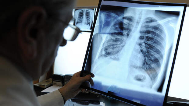 Боль в плече у мужчины оказалась симптомом рака легких