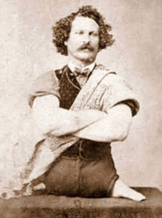 Фокомелия – не приговор. Человек-тюлень доказал это на своём примере