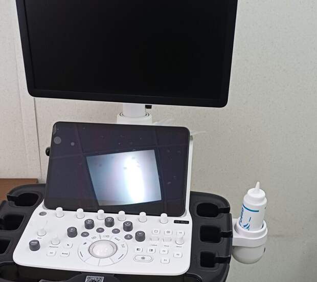 Рязанский кардиодиспансер получил новый УЗИ-аппарат с функцией strain