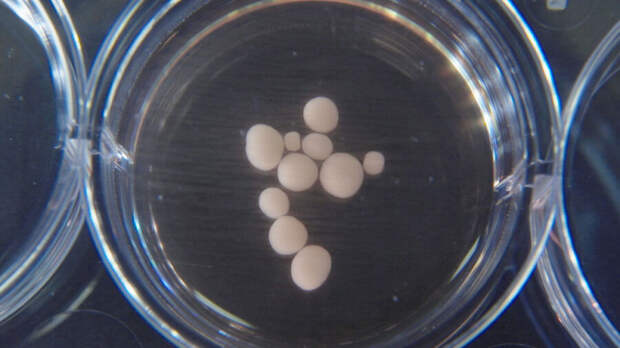 neuroscience 10 months old pea-sized brain organoids