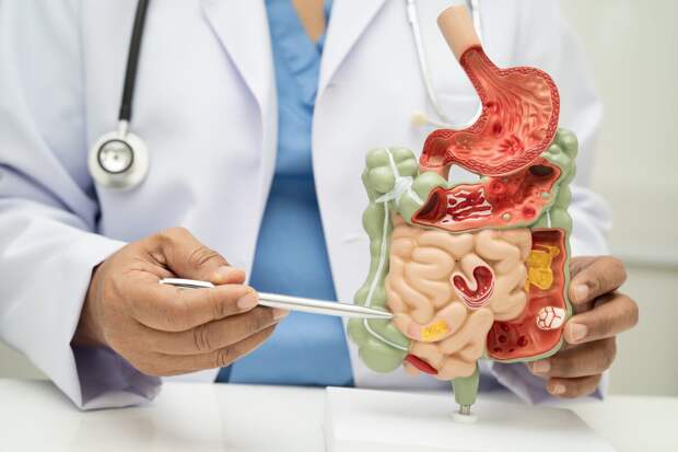 Врач перечислила разрушающие здоровье кишечника продукты