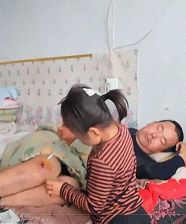Жена, с которой он прожил 7 лет, ушла спустя 2 месяца, оставив ему 4-летнюю дочь  дочь, истории, китай, отец, парализованный, помощь, фото