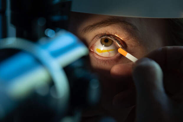 MedicalXpress: сильная близорукость повышает риск развития глаукомы