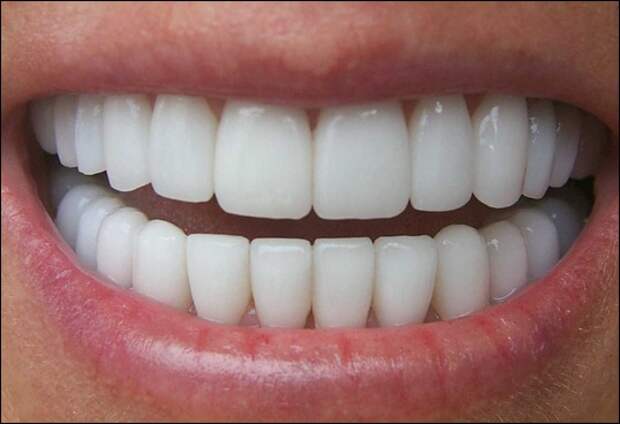 zubi zub ulibka zdorovie zubi zubi ulibka belie zubi zubi cheloveka chistit zubi 68970192115