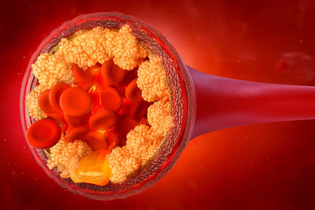 Circulation: уровень холестерина в организме определяет белок HELZ2