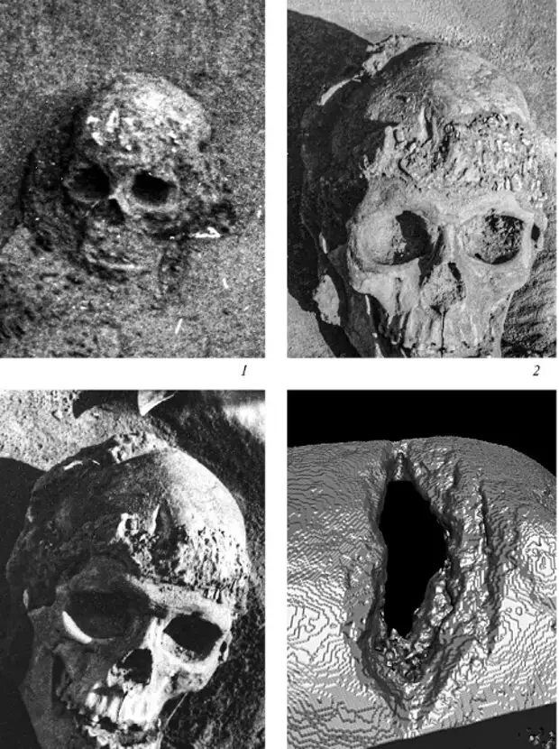 Компьютерная томография позволила изучить особенности строения черепа человека Сунгирь-1