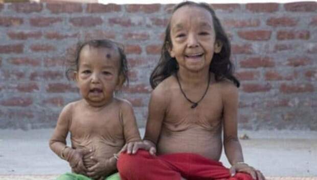 Почему брат и сестра из Индии выглядят, как маленькие старички
