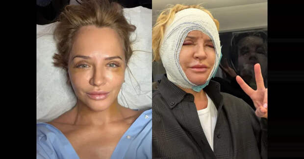 Виктория Шелягова сделала пластическую операцию на лице