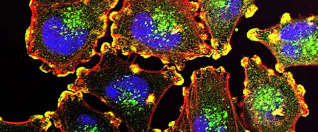 Иммунотерапия показала отличный результат на третьей стадии меланомы