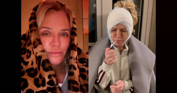 Виктория Шелягова показала, как восстанавливается после пластической операции на лице