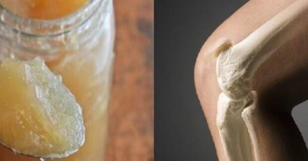 unbelievable-healed-joints-and-bones-with-a-single-ingredient-that-we-all-have-in-the-kitchen