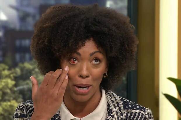 Телеведущий заметил у гостьи шоу пугающий симптом и прервал прямой эфир