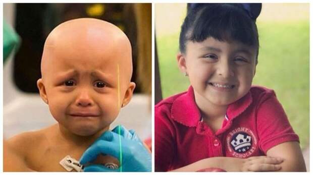 Люди, которые боролись с раком и победили: снимки "до" и "после" вдохновляющее, выжившие, до и после, заболевание, рак, сильные духом