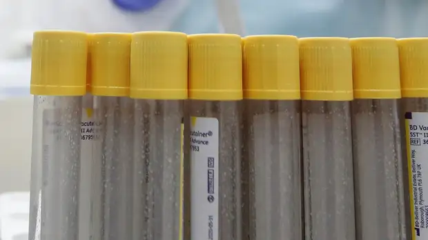 В Кировской области подтвердили 148 случаев коронавируса за сутки