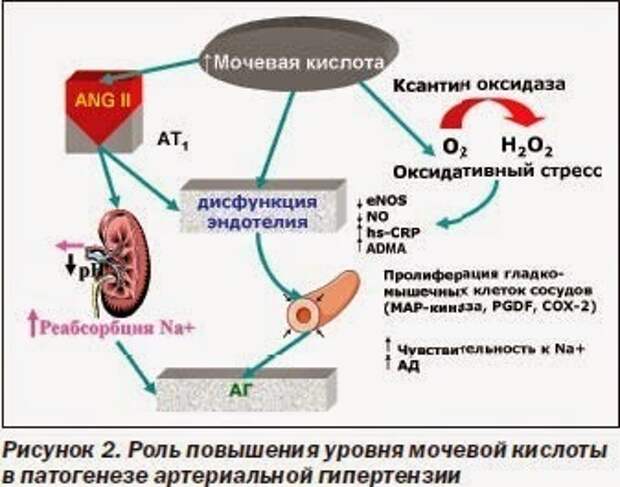 Мочевая кислота повышена: влияние на здоровье