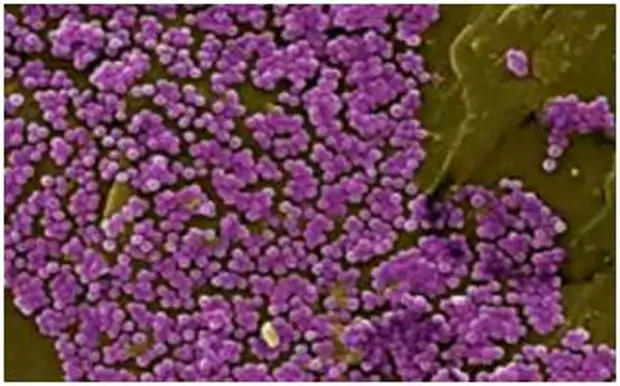 Стафилококк картинки. Staphylococcus lugdunensis. Стафилококк лукдунезис. Стафилококк лугдуненсис что это. Staphylococcus lugdunensis.